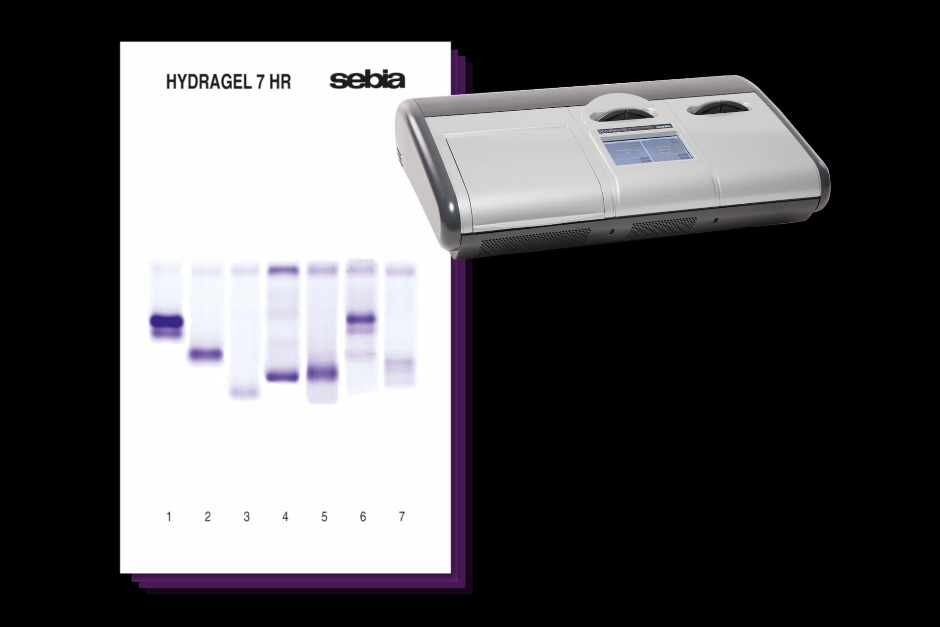 Sebia Urine Protein Gel, provided by the HYDRASYS 2 SCAN FOCUSING instrument
