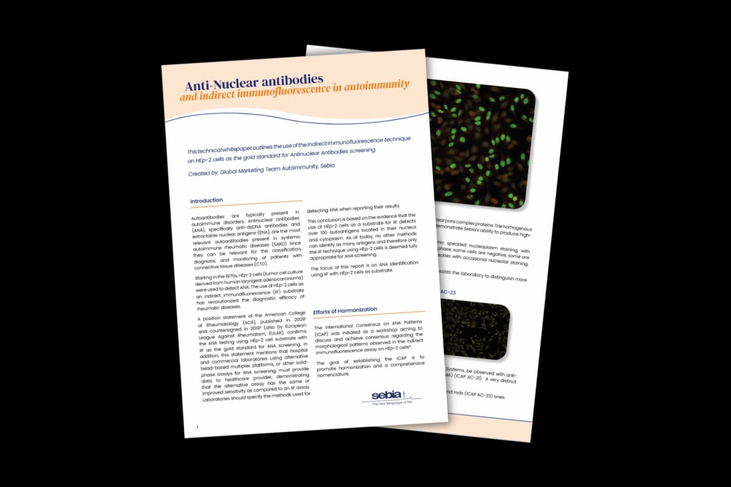 HEp-2 cells: a reliable tool for antinuclear antibodies screening