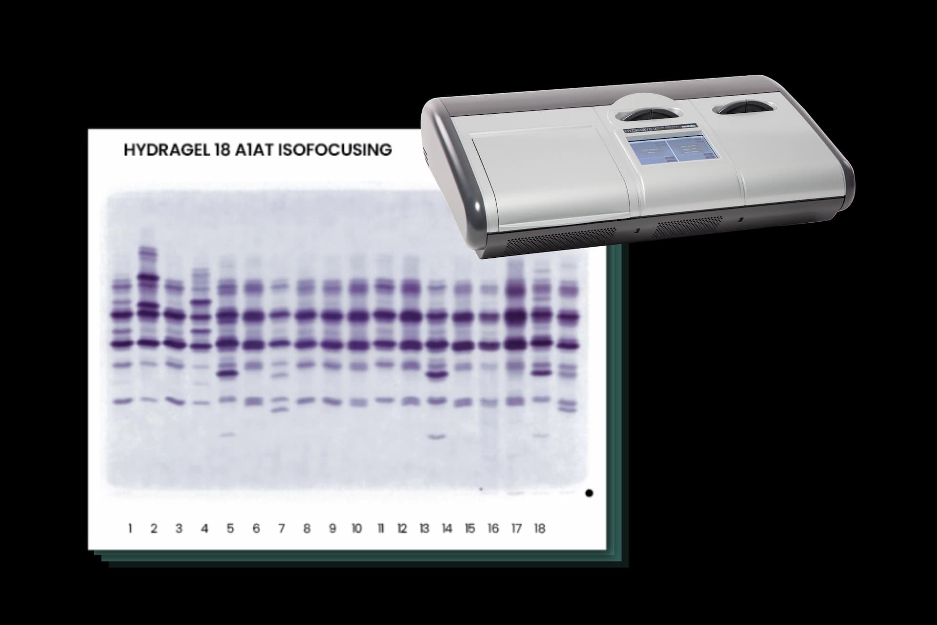 Sebia A1AT Gel, provided by the HYDRASYS 2 SCAN FOCUSING instrument