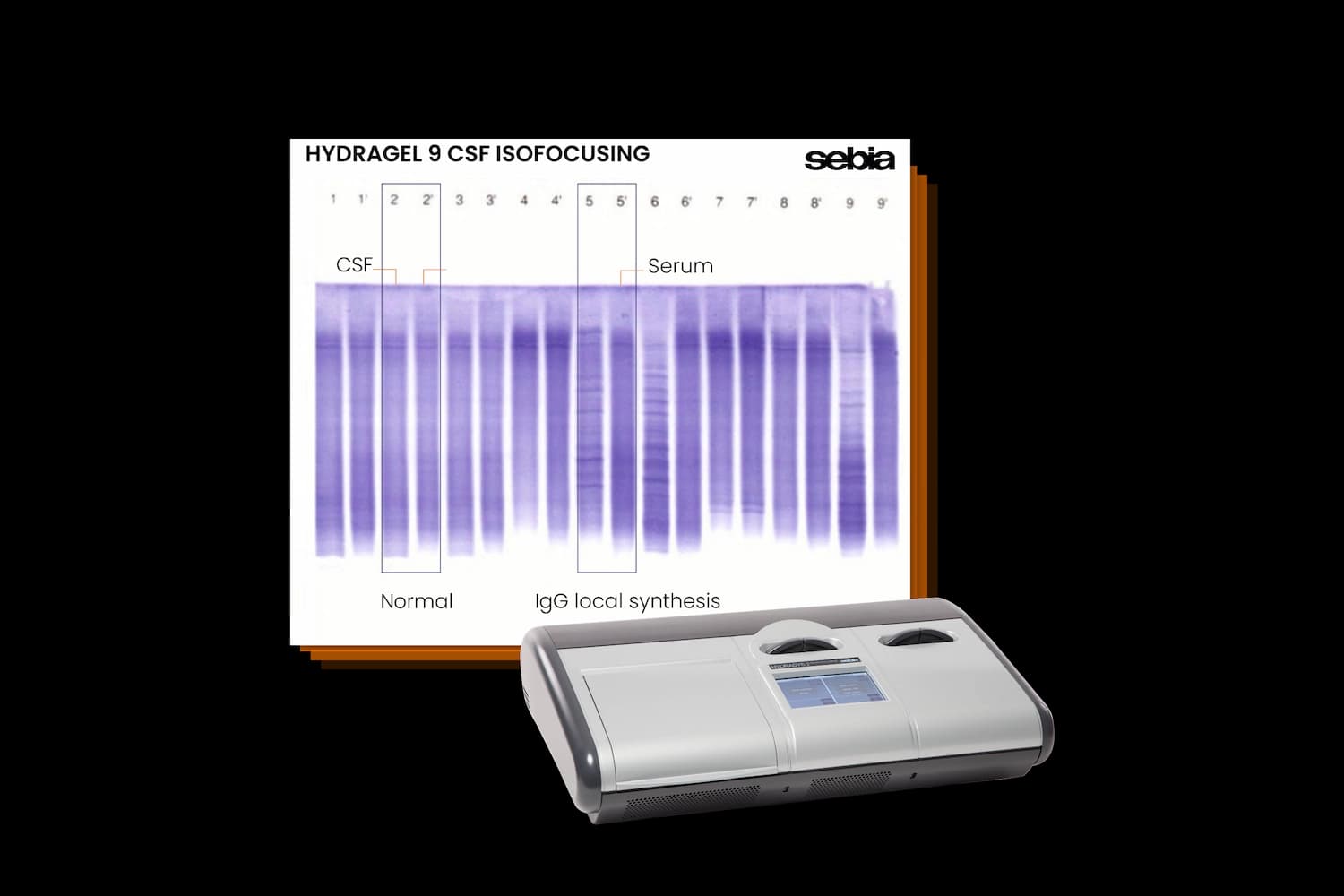 Sebia CSF Gel, provided by the HYDRASYS 2 SCAN FOCUSING instrument