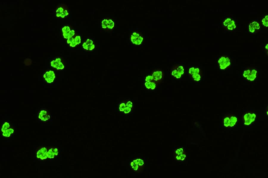 Sebia IFA ANCA Ethanol Fixed slide