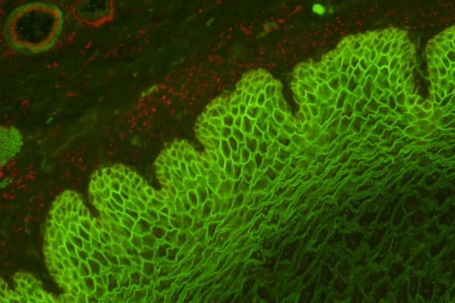 Sebia Intercellular pattern
