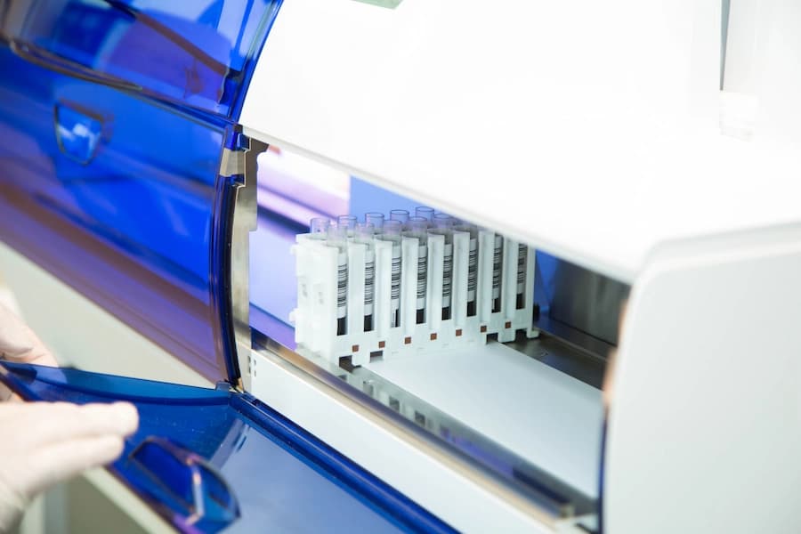 Sebia capillary electrophoresis technology on a CAPILLARYS 3 instrument