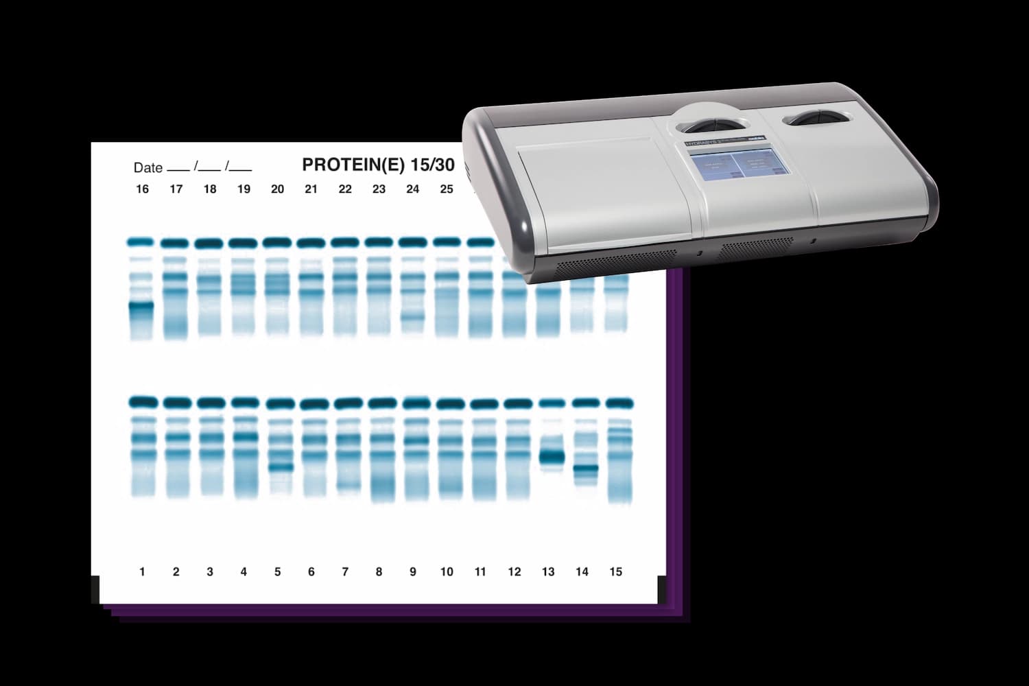 Sebia Serum Protein Gel, provided by the HYDRASYS 2 SCAN FOCUSING instrument