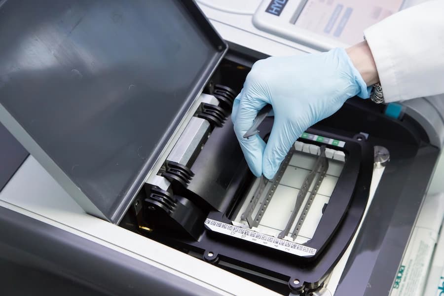 Sebia HYDRASYS 2 SCAN FOCUSING instrument opened with a visible gel and a lab technician's hand